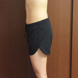 DNAパーソナル痩身コース