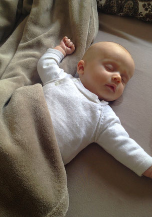 Baby mit KISS Syndrom