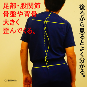側弯症・背中・腰・首の痛みは、昭島市のオサモミ整体院