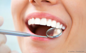 Vor der professionellen Zahnreinigung werden die Zähne und das Zahnfleisch untersucht. (© yanlev - Fotolia.com)