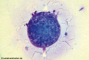 Blutzelleen mit blau gefärb- ter Granula, den Zytosomen.