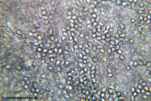 Zu den Endoparasiten bei Garnelen und Flusskrebsen zählen beispielsweise Sporozoen.