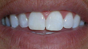 cosmetic dentist spanish fork