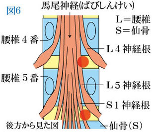 神経根の圧迫