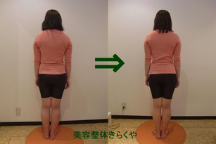 (結果には個人差があります。施術6回・期間2ヶ月)
