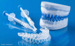 Bleaching-Set vom Zahnarzt für die Zahnaufhellung zu Hause.