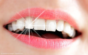 Können auch einzelne Zähne aufgehellt werden?