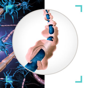 Darstellung von Nerven und Rückenmark – Symbolbild für Multiple Sklerose. Praxis Neuro im Zentrum St. Gallen