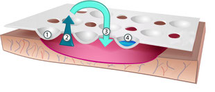 Cutimed Sorbion Plus Wirkung Illustration