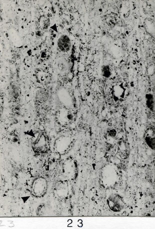 Fig. 23 (= E 70): Querschliff, 80 x. Poren durch sklerotische Thyllen häufig mit verdickten Wänden ► oder geteilten Lumina ►