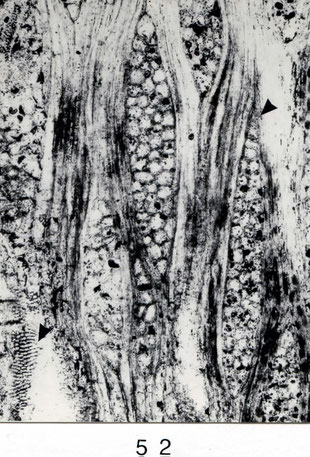 Fig. 52 (= A VI 26): Tangentialschliff, 80 x. Gefäß mit feinen Hoftüpfeln >. Holzstrahlen mehrreihig und leicht heterogen ►