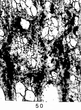 Fig. 50: Ulmoxylon sp. GOTTWALD 2004 (= VH7388). Querschliff; Poren im Frühholz grob und locker ringförmig geordnet, teils verthyllt; im Spätholz ähnlich Celtixylon feinporig und in tangentialen Gruppen.