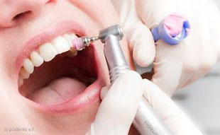 Eine der besten Vorbeugemaßnahmen gegen Mundgeruch: Regelmäßige professionelle Zahnreinigung (PZR)!