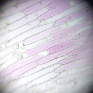 Mikroskopaufnahme von Zwiebelzellen