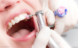 Professionelle Zahnreinigung (PZR): Schutz vor Karies, Parodontose und Mundgeruch.