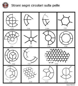 Strani segni circolari sulla pelle