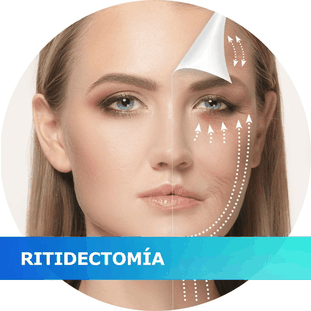 Ritidectomia