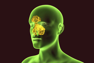 Sinusitis vermeiden Medikamente Beratung beim HNO Arzt Nasennebenhöhlen Schmerzen