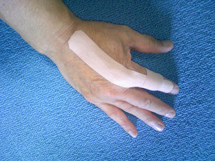 手の指の痛み