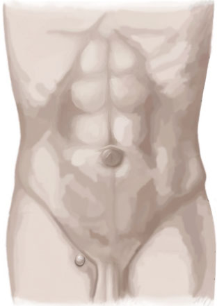 Femoralhernie - Hernienzentrium.Berlin