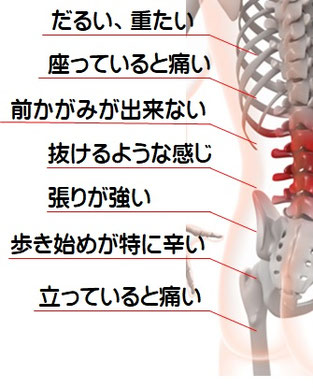 腰痛の症状　だるい、重たいなど