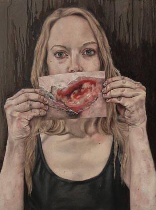 Lydia Balke