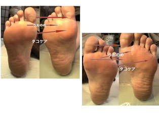 ビフォーアフター