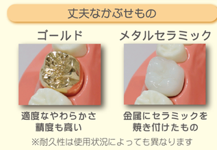 八戸市　くぼた歯科医院　セラミック　白い　オススメ　ホワイトニング