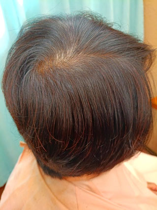 N様HQヘナとシコン色で2度染め、3ヶ月後