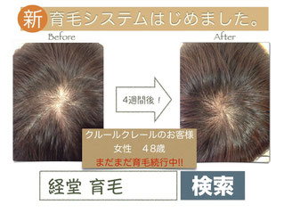 経堂 育毛 検索