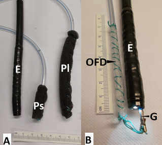 Openpore drainages: short and long open-pore polyurethane-foam drainages (OPD) and small-bore openpore film drainage (OFD).