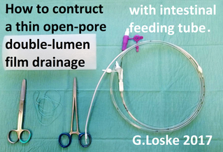 Material for construction of an double-lumen openpore film drainage (OFD): Trilumina-tube (Fresenius), openpore film (L&R, CNP-Drainagefilm), suture.