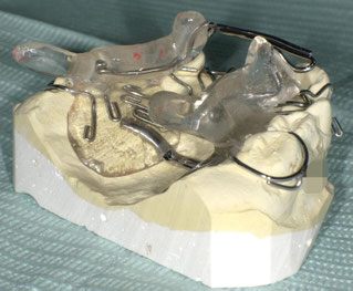 顎顔面口腔育成治療 先進的な矯正、バイオブロック・RAMPAなら京都