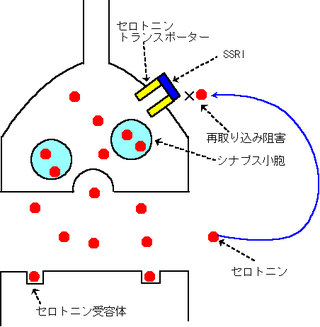 SSRI, SNRIとはSSRI,SNRIの吐き気の副作用は？