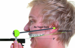 トーシンデンタル　ジルコンザーン　プレーンファインダー　フェイスハンター　プレーンシステム　ナチュラルヘッドポジション（ＮＨＰ）