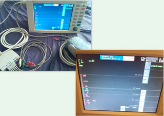 Lohmeier M211 Monitor für Medizin und Praxis