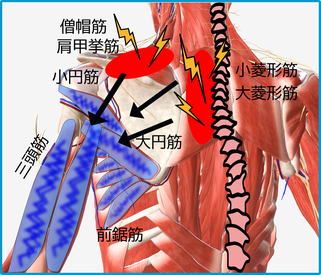 三頭筋の縮こまり