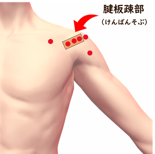 肩関節の施術画像