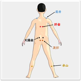 生理痛更年期の置き鍼画像