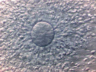 顆粒膜細胞に包まれた卵子