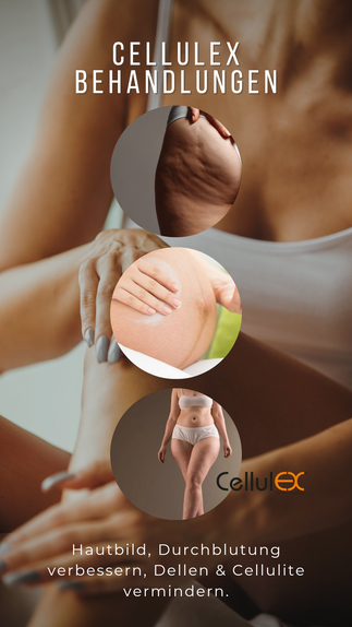 Vorteile der Cellulex Behandlung basel