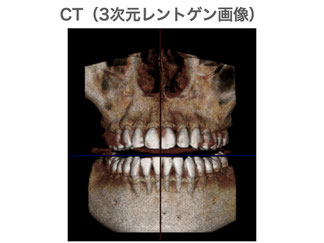 CT