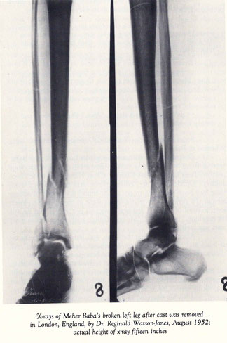 Couretsy of Lord Meher 1st edition- page 3892. It's unclear where the x-rays were taken, USA or England.