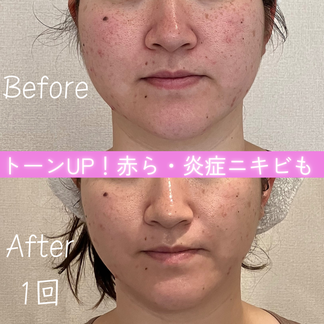 セルラム　ビフォーアフター
