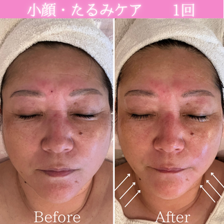 セルラム　ビフォーアフター