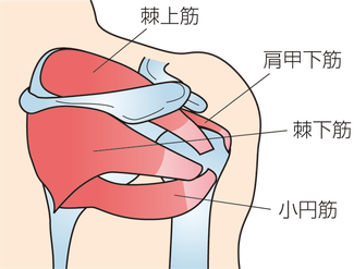 腱板損傷画像