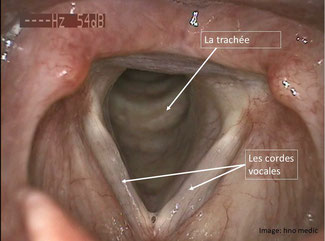le larynx 