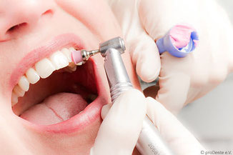 Professionelle Zahnreinigung: Schutz vor Karies, Parodontose und Mundgeruch