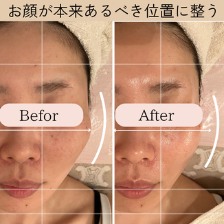 小顔ケア　ビフォーアフター