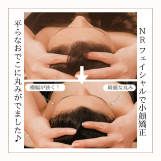 脳内洗浄　ビフォーアフター